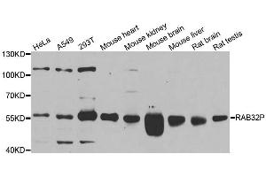 Western Blotting (WB) image for anti-RAB3A Interacting Protein (Rabin3) (RAB3IP) (AA 1-150) antibody (ABIN6146588)