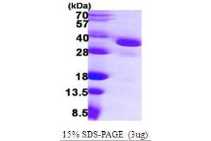 SDS-PAGE (SDS) image for Eukaryotic Translation Initiation Factor 2B, Subunit 1 Alpha, 26kDa (EIF2B1) (AA 1-305) protein (His tag) (ABIN6386741) (EIF2B1 Protein (AA 1-305) (His tag))