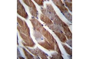 Immunohistochemistry analysis in formalin fixed and paraffin embedded human skeletal muscle reacted with Matrilin-1 Antibody (C-term) followed which was peroxidase conjugated to the secondary antibody and followed by DAB staining. (MATN1 Antikörper  (C-Term))