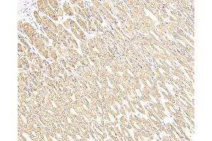 Immunohistochemistry analysis of paraffin-embedded mouse stomach cancer using CK-7 Monoclonal Antibody at dilution of 1:300. (Cytokeratin 7 Antikörper)