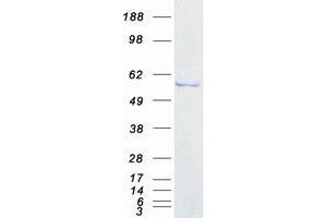 Western Blotting (WB) image for DEAD (Asp-Glu-Ala-Asp) Box Polypeptide 6 (DDX6) protein (Myc-DYKDDDDK Tag) (ABIN2719316)