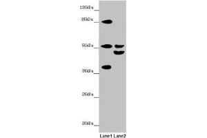 Western blot All lanes: NYX antibody at 7. (Nyctalopin Antikörper  (AA 282-481))