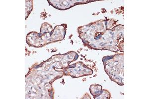 Immunohistochemistry of paraffin-embedded human placenta using RPS6K antibody (ABIN7270037) at dilution of 1:100 (40x lens). (RPS6KA2 Antikörper  (AA 632-733))