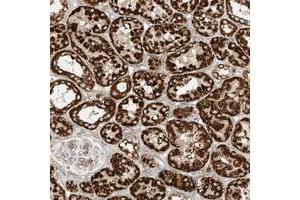 Immunohistochemical staining of human kidney with PLCL1 polyclonal antibody  shows strong cytoplasmic positivity, with a granular pattern in renal tubular cells at 1:200-1:500 dilution. (PLCL1 Antikörper)