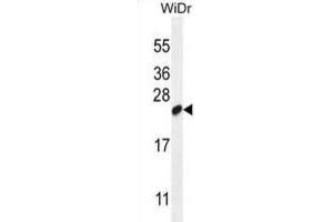 Western Blotting (WB) image for anti-Chromosome 19 Open Reading Frame 84 (C19orf84) antibody (ABIN2995151) (C19orf84 Antikörper)