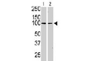 The KIT polyclonal antibody  is used in Western blot to detect KIT in serum-starved HeLa cell lysate (lane 1) and primate testis tissue lysate (lane 2) .