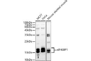 Western blot analysis of extracts of various cell lines, using eIF4EBP1 antibody (ABIN3021843, ABIN3021844, ABIN3021845 and ABIN1512858) at 1:1000 dilution. (eIF4EBP1 Antikörper  (C-Term))
