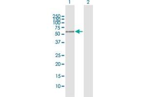 Western Blot analysis of PLEKHO2 expression in transfected 293T cell line by PLEKHO2 MaxPab polyclonal antibody. (PLEKHO2 Antikörper  (AA 1-440))