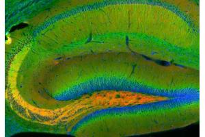 Immunohistochemistry (IHC) image for anti-alpha Tubulin (TUBA1) (AA 443-449) antibody (ABIN1742552) (alpha Tubulin Antikörper  (AA 443-449))