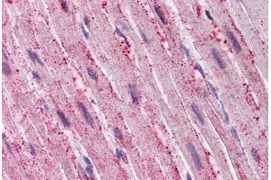Human Heart (formalin-fixed, paraffin-embedded) stained with ADAMTS4 antibody ABIN290073 at 20 ug/ml followed by biotinylated goat anti-rabbit IgG secondary antibody ABIN481713, alkaline phosphatase-streptavidin and chromogen.