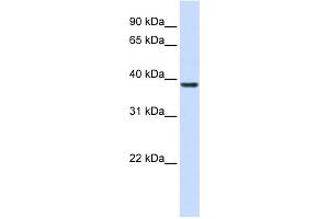 WB Suggested Anti-RASSF7 Antibody Titration: 0. (RASSF7 Antikörper  (Middle Region))
