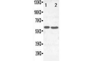 Anti-SLC22A6 antibody, Western blotting Lane 1:  Cell Lysate Lane 2: HELA Cell Lysate (SLC22A6 Antikörper  (C-Term))