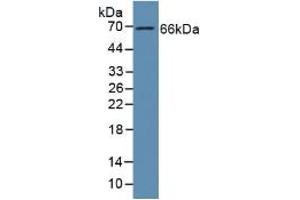 Western Blotting (WB) image for Growth Arrest-Specific 6 (GAS6) ELISA Kit (ABIN6720504)