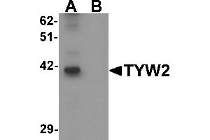 Western blot analysis of TYW2 in K562 cell lysate with TYW2 antibody at 0. (TRMT12 Antikörper  (N-Term))