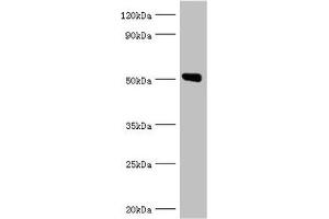 Western blot All lanes: Annexin A11 antibody at 14 μg/mL + U251 whole cell lysate Secondary Goat polyclonal to rabbit IgG at 1/10000 dilution Predicted band size: 55, 52 kDa Observed band size: 52 kDa (Annexin A11 Antikörper  (AA 276-505))