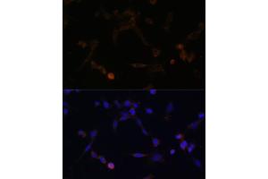 Immunofluorescence analysis of NIH/3T3 cells using UBE2L6 antibody (ABIN6134446, ABIN6149808, ABIN6149809 and ABIN6217753) at dilution of 1:100. (UBE2L6 Antikörper  (C-Term))