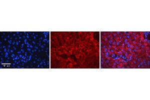 Rabbit Anti-ERCC8 Antibody    Formalin Fixed Paraffin Embedded Tissue: Human Adult liver  Observed Staining: Cytoplasmic,Nuclear Primary Antibody Concentration: 1:600 Secondary Antibody: Donkey anti-Rabbit-Cy2/3 Secondary Antibody Concentration: 1:200 Magnification: 20X Exposure Time: 0. (ERCC8 Antikörper  (N-Term))