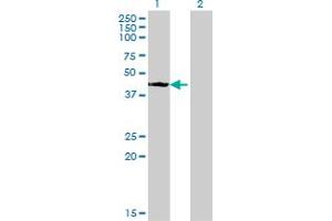 Western Blot analysis of STYK1 expression in transfected 293T cell line by STYK1 monoclonal antibody (M02), clone 3D2. (STYK1 Antikörper  (AA 50-159))
