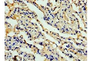 Immunohistochemistry of paraffin-embedded human lung tissue using  at dilution of 1:100 (CCL11 Antikörper  (AA 1-97))