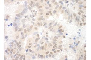 anti-Sin3A-Associated Protein, 130kDa (SAP130) (AA 325-375) antibody