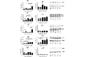 mRNA expression (all n = 6) of HRas, MAPK14 (p38), CCL2, DOK1 and PTK2B related to GAPDH mRNA expression, protein expression of HRas (n = 6), p38 (n = 6), CCL2 (n = 4), DOK1 (n = 7-8) and PTK2B (n = 3) related to GAPDH expression in A549 () and A549rCDDP2000 () before (ctrl) and after treatment with 11 μM cisplatin (11) or 34 μM cisplatin (34) presented as mean ± SEM, as well as representative Western blots. (DOK1 Antikörper)