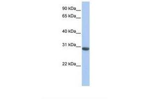 Image no. 1 for anti-Myeloid Leukemia Factor 1 (MLF1) (AA 38-87) antibody (ABIN6738901)
