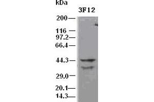 DFF45 antibody (3F12) at 1:500 dilution + Hela cell lysate (DFFA Antikörper)
