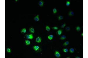 Immunofluorescent analysis of A2780 cells using ABIN7165108 at dilution of 1:100 and Alexa Fluor 488-congugated AffiniPure Goat Anti-Rabbit IgG(H+L) (ARV1 Antikörper  (AA 1-143))
