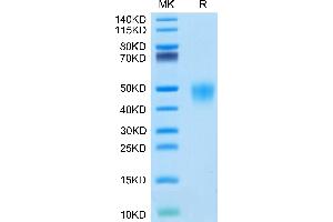 Cynomolgus Fc gamma RIII on Tris-Bis PAGE under reduced condition. (Fc gamma RII (CD32) (AA 17-208) protein (His tag))