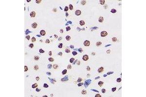 Immunohistochemical analysis of BAF155 staining in human kidney formalin fixed paraffin embedded tissue section. (SMARCC1 Antikörper)