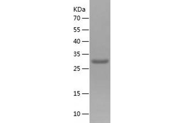 TNS3 Protein (AA 366-571) (His tag)