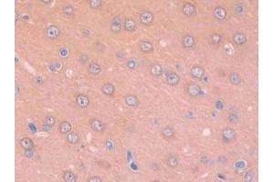 IHC-P analysis of Rat Cerebrum Tissue, with DAB staining. (Renin Antikörper  (AA 144-237))
