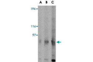 Western blot analysis of GRIK4 in rat brain tissue lysate with GRIK4 polyclonal antibody  at (A) 0. (GRIK4 Antikörper  (C-Term))