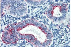 Human Uterus: Formalin-Fixed, Paraffin-Embedded (FFPE) (TYMS Antikörper  (AA 111-211))