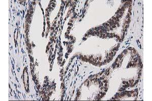 Image no. 1 for anti-Protein Kinase C, epsilon (PRKCE) antibody (ABIN1500230) (PKC epsilon Antikörper)