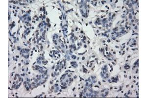 Immunohistochemical staining of paraffin-embedded breast tissue using anti-IRF3 mouse monoclonal antibody. (IRF3 Antikörper)