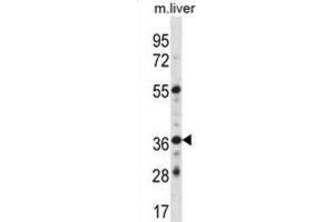 Western Blotting (WB) image for anti-G Protein-Coupled Estrogen Receptor 1 (GPER) antibody (ABIN2998385) (GPER Antikörper)