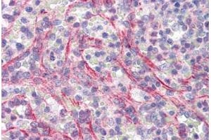 Immunohistochemistry (Paraffin-embedded Sections) (IHC (p)) image for anti-Solute Carrier Family 29 (Nucleoside Transporters), Member 1 (SLC29A1) (AA 234-263) antibody (ABIN462073)