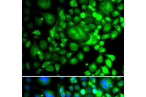 Immunofluorescence analysis of A549 cells using SNX3 Polyclonal Antibody (Sorting Nexin 3 Antikörper)
