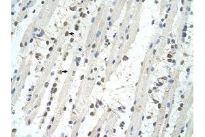 TRIM32 antibody was used for immunohistochemistry at a concentration of 4-8 ug/ml to stain Skeletal muscle cells (arrows) in Human Muscle. (TRIM32 Antikörper  (C-Term))