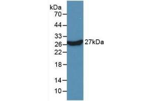 Detection of Recombinant KPNa2, Human using Monoclonal Antibody to Karyopherin Alpha 2 (KPNa2) (KPNA2 Antikörper  (AA 157-412))