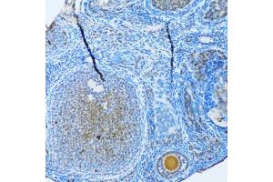 Immunohistochemistry of paraffin-embedded rat ovary using MAP1LC3B antibody (ABIN5973262) at dilution of 1/100 (20x lens). (LC3B Antikörper)