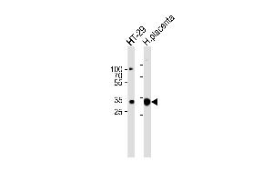 Western blot analysis of lysates from HT-29 cell line and human placenta tissue lysate(from left to right),using GJB7 Antibody (ABIN6241921). (GJB7 Antikörper)