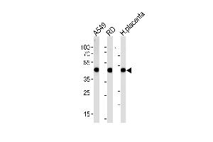 Western blot analysis in A549,RD cell line and human placenta lysates (35ug/lane). (Actin Antikörper  (C-Term))
