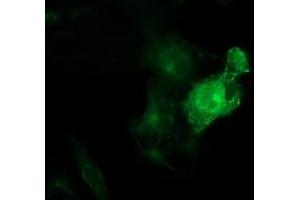Anti-TUBB4 mouse monoclonal antibody (ABIN2454747) immunofluorescent staining of COS7 cells transiently transfected by pCMV6-ENTRY TUBB4 (RC203945). (TUBB4 Antikörper)