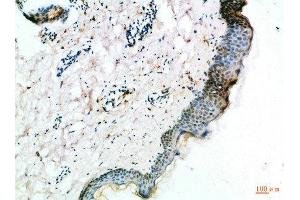 Immunohistochemical analysis of paraffin-embedded Human-skin, antibody was diluted at 1:100 (FZD4 Antikörper  (AA 11-60))