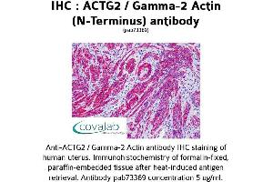 Image no. 1 for anti-Actin, gamma 2, Smooth Muscle, Enteric (ACTG2) antibody (ABIN1731474) (ACTG2 Antikörper)