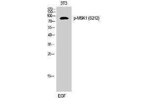 Western Blotting (WB) image for anti-Ribosomal Protein S6 Kinase, 90kDa, Polypeptide 5 (RPS6KA5) (pSer212) antibody (ABIN3179703) (MSK1 Antikörper  (pSer212))