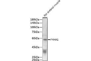 Western blot analysis of extracts of Rat skeletal muscle, using P4H antibody (0538) at 1:500 dilution.