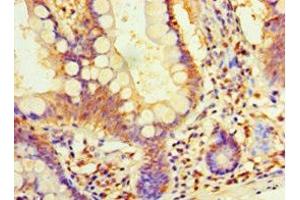 Immunohistochemistry of paraffin-embedded human small intestine tissue using ABIN7164411 at dilution of 1:100 (DIMT1 Antikörper  (AA 1-313))